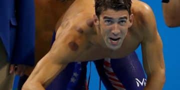 Hijama Therapy for Olympians